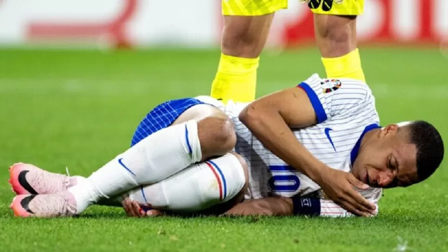 Kylian Mbappé fractura nariz
