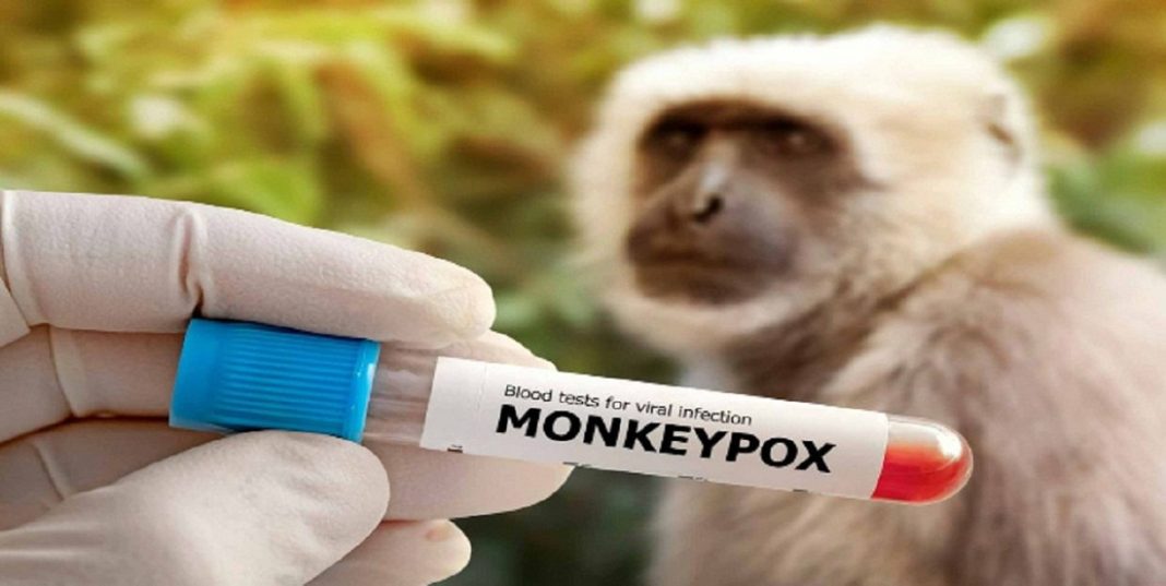 mpox frontera