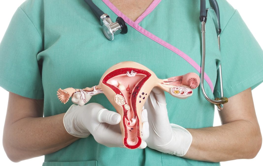 cáncer de cuello uterino