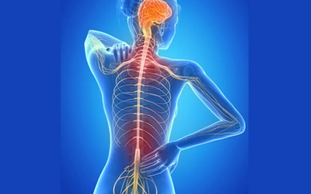 esclerosis múltiple
