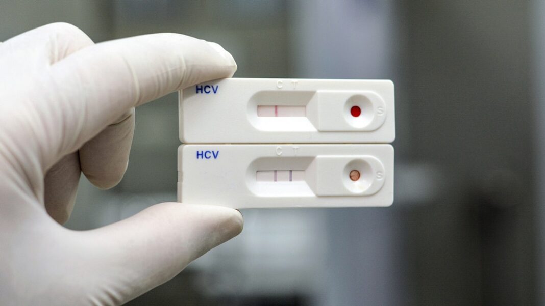 Rusia prueba hepatitis C